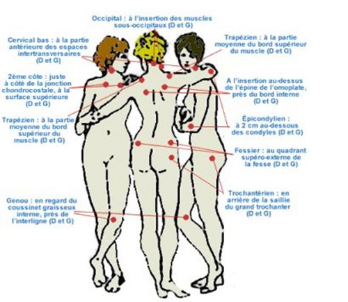 Fait mal le dos au cancer de lestomac de 4 degrés